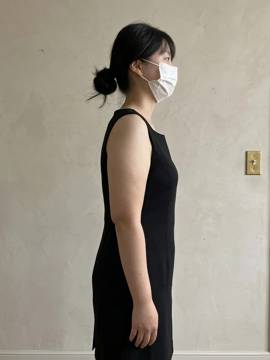 G-fat arm extraction before, G Clinic Gangnam case 13