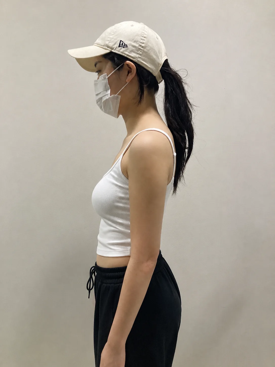 G-fat arm extraction after, G Clinic Gangnam case 62