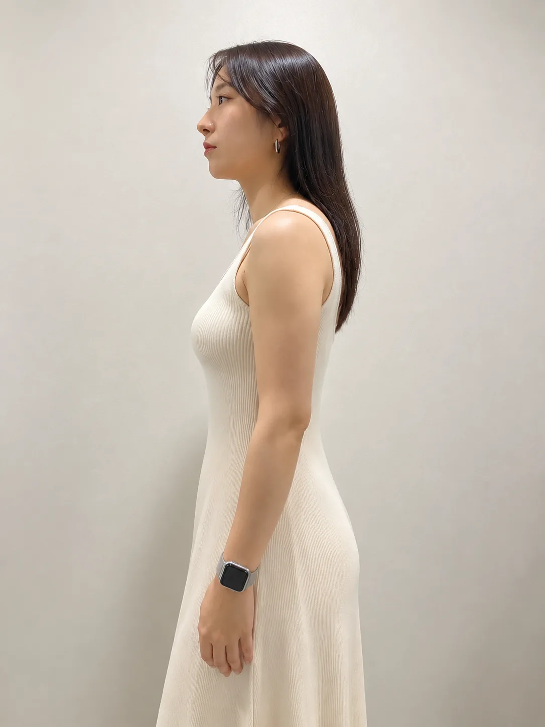 G-fat arm extraction after, G Clinic Gangnam case 70