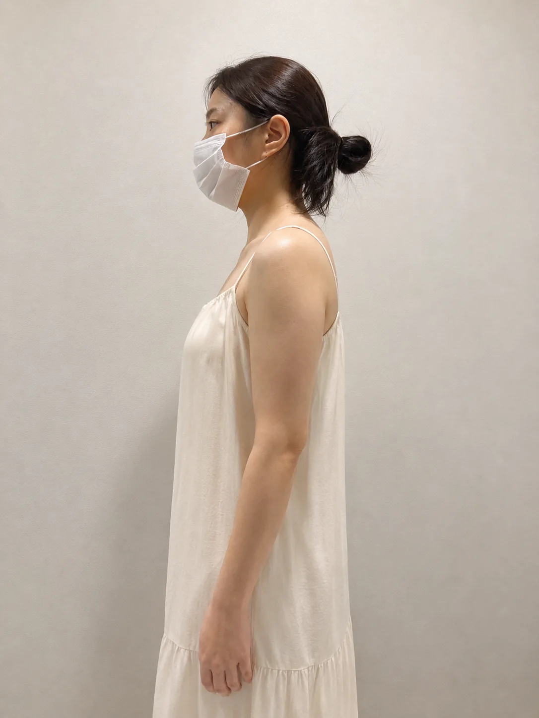 G-fat arm extraction before, G Clinic Gangnam case 70